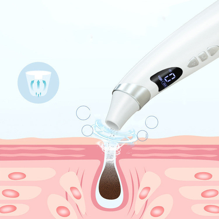 Electric Visual Blackhead Suction Instrument – Household Pore Cleaner with Adjustable Suction & USB Rechargeable