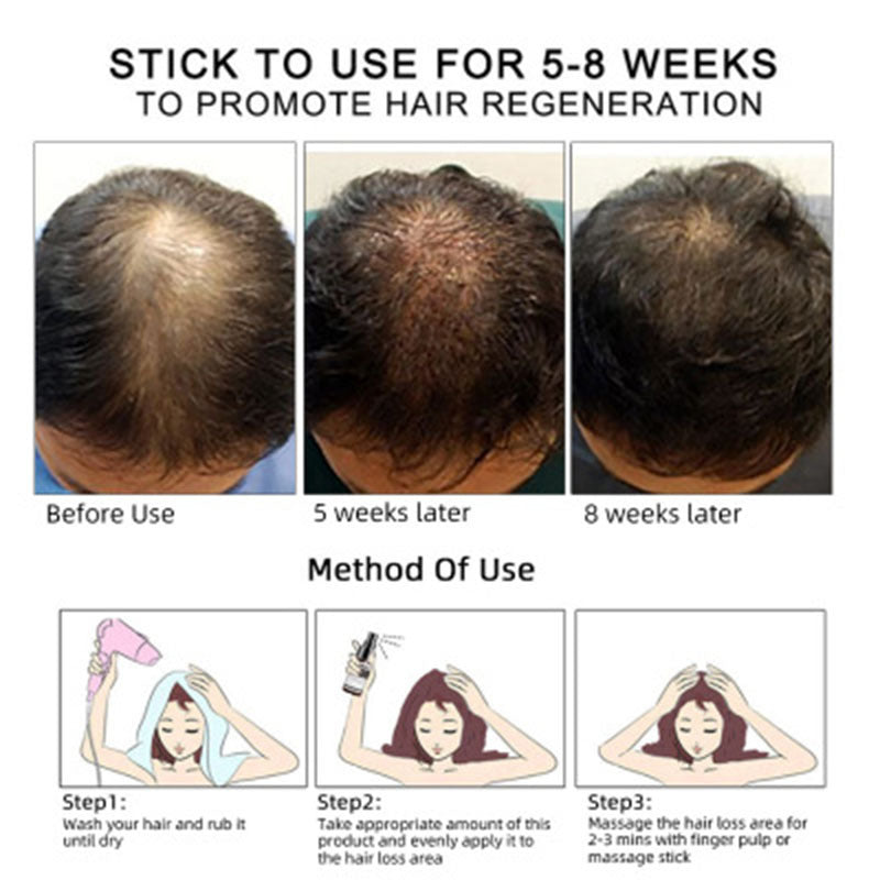 Natural Hair Growth Oil – Nourishing Essential Oil for Scalp Health and Hair Strengthening