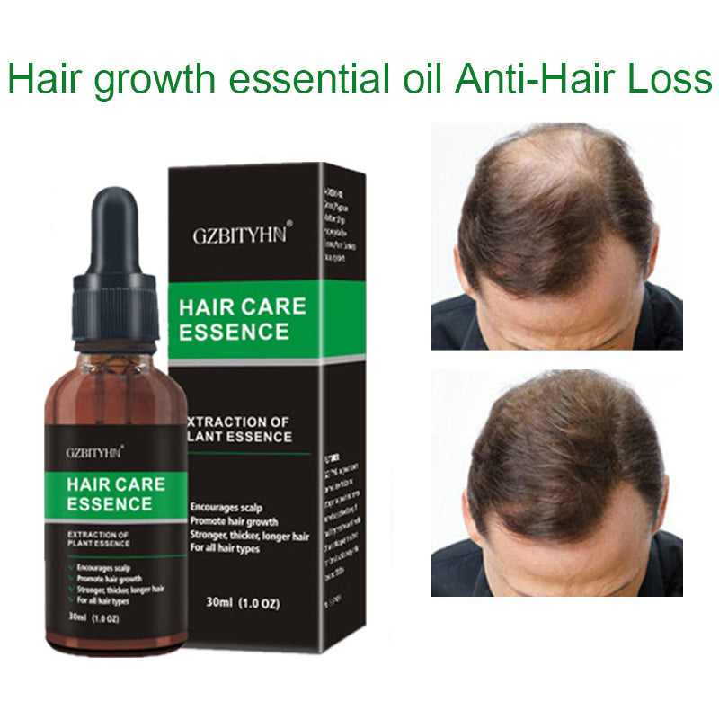 Natural Hair Growth Oil – Nourishing Essential Oil for Scalp Health and Hair Strengthening