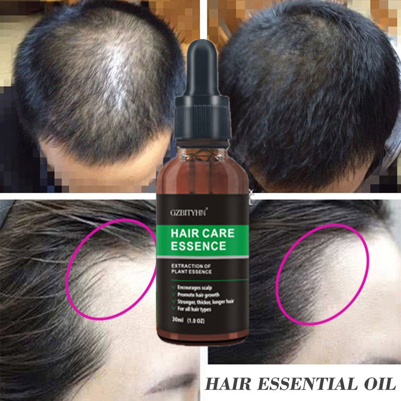 Natural Hair Growth Oil – Nourishing Essential Oil for Scalp Health and Hair Strengthening